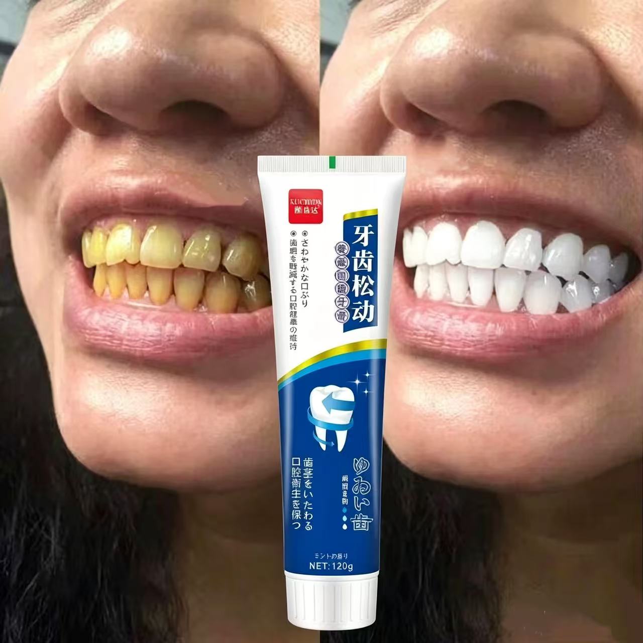 Fix Loose Teeth Japanese Impor - đánh giá và giá Teeth Whitening Japanese