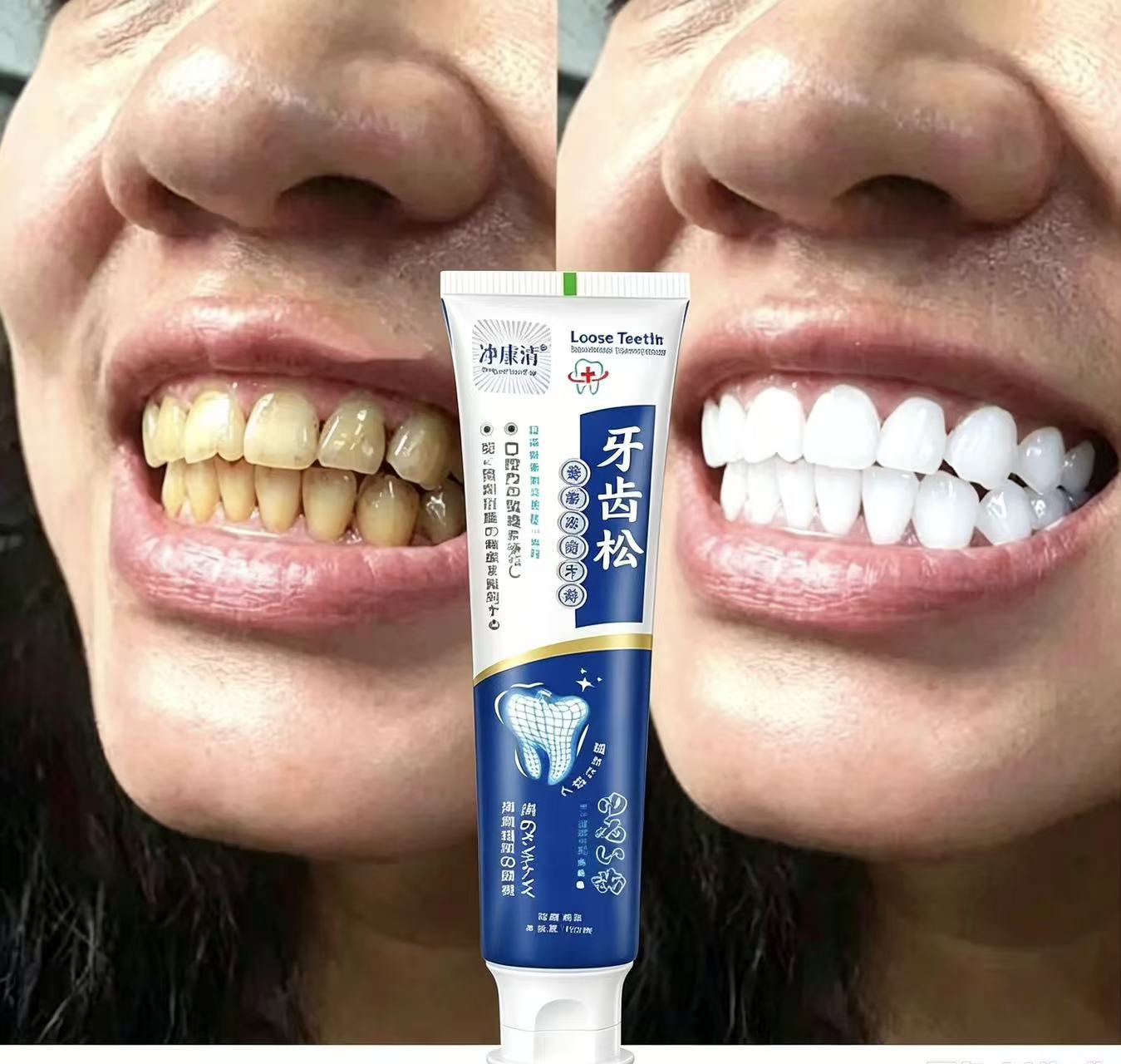 Fix Loose Teeth Japanese Impor - đánh giá và giá Teeth Whitening Japanese