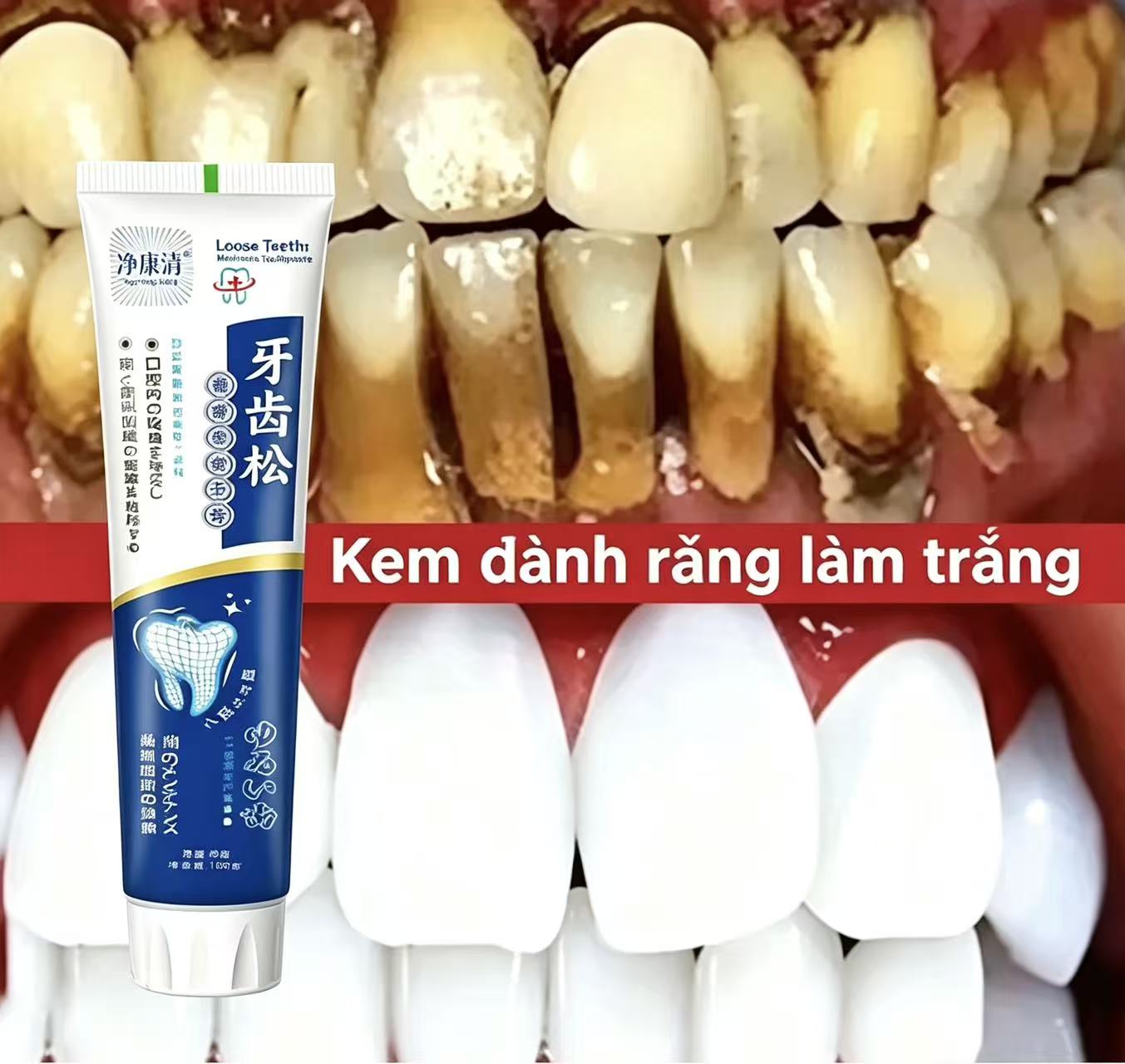 Fix Loose Teeth Japanese Impor - đánh giá và giá Teeth Whitening Japanese