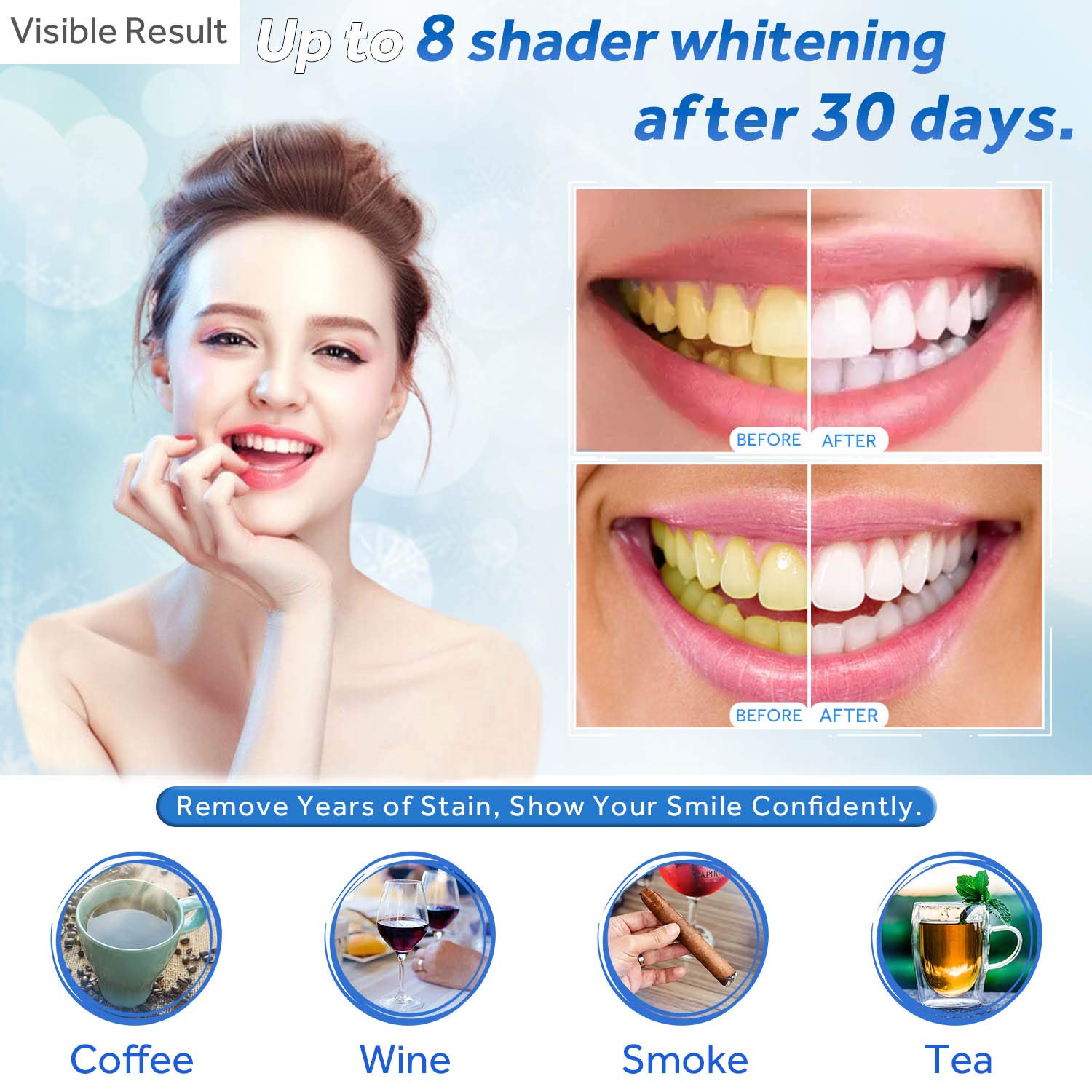 Teeth Whitening Gel Refill Syr - đánh giá và giá Teeth Whitening Hydrogen Peroxide