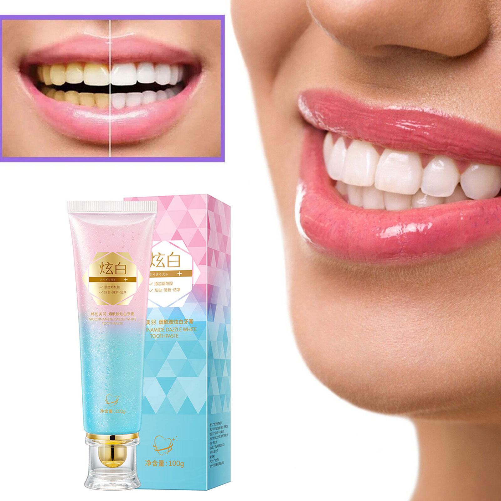 Niacinamide Whitening Toothpas - đánh giá và giá Teeth Whitening Toothpaste