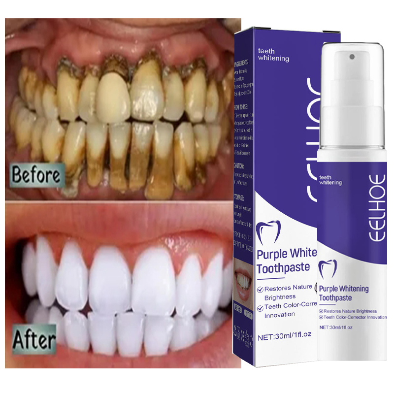 1pcs Teeth Cleansing Whitening - đánh giá và giá Teeth Whitening In Korea