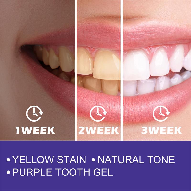 1pcs Teeth Cleansing Whitening - đánh giá và giá Teeth Whitening In Korea