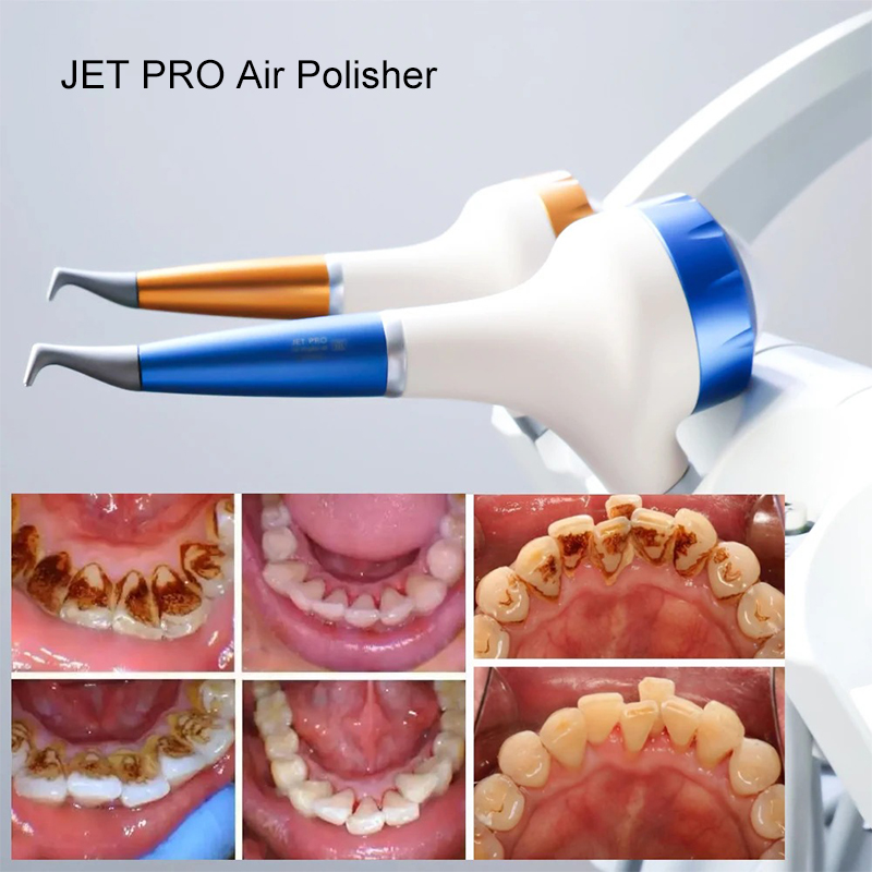 VV Dental  Air Polishing Proph - đánh giá và giá Teeth Whitening China