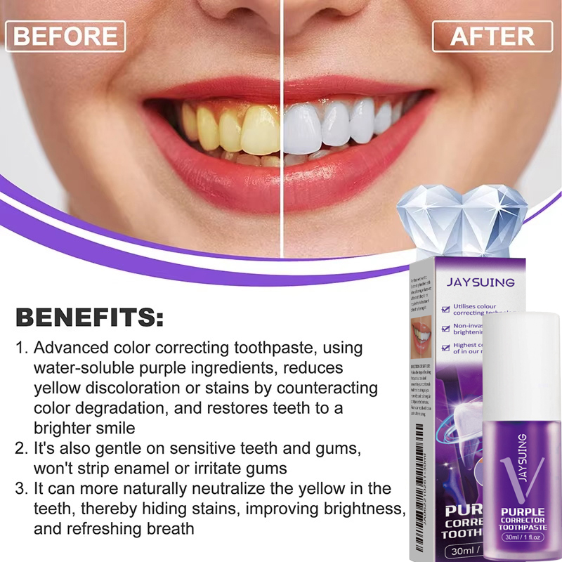 Teeth Cleansing Whitening Toot - đánh giá và giá Teeth Whitening In Korea