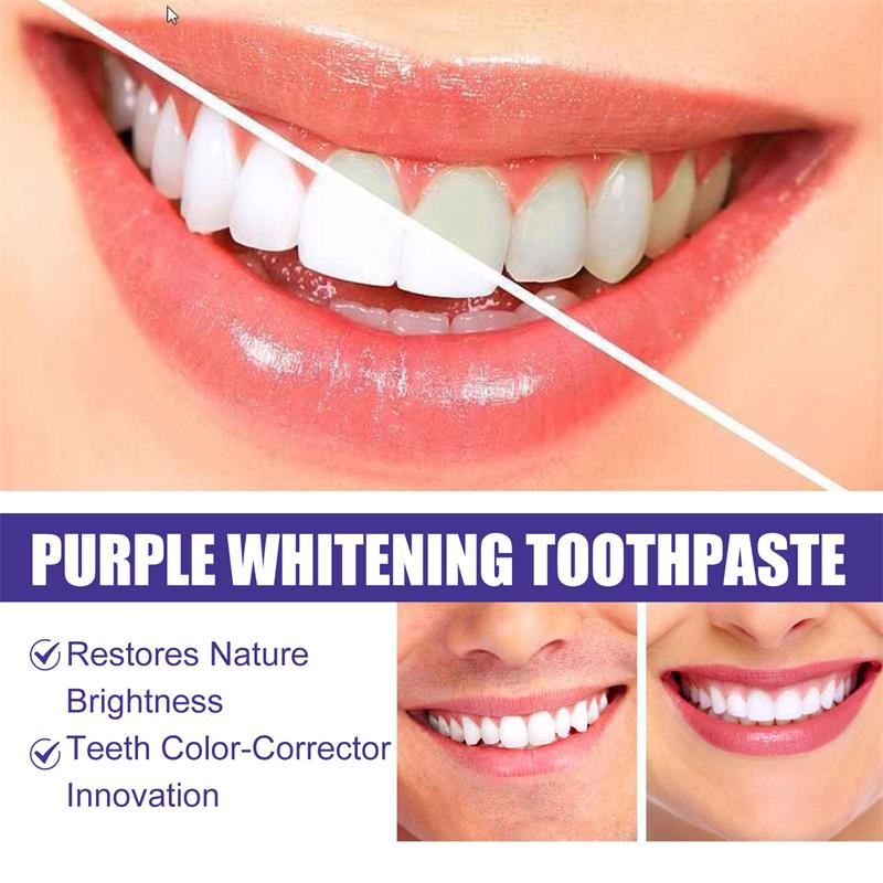 Teeth Cleansing Whitening Toot - đánh giá và giá Teeth Whitening In Korea