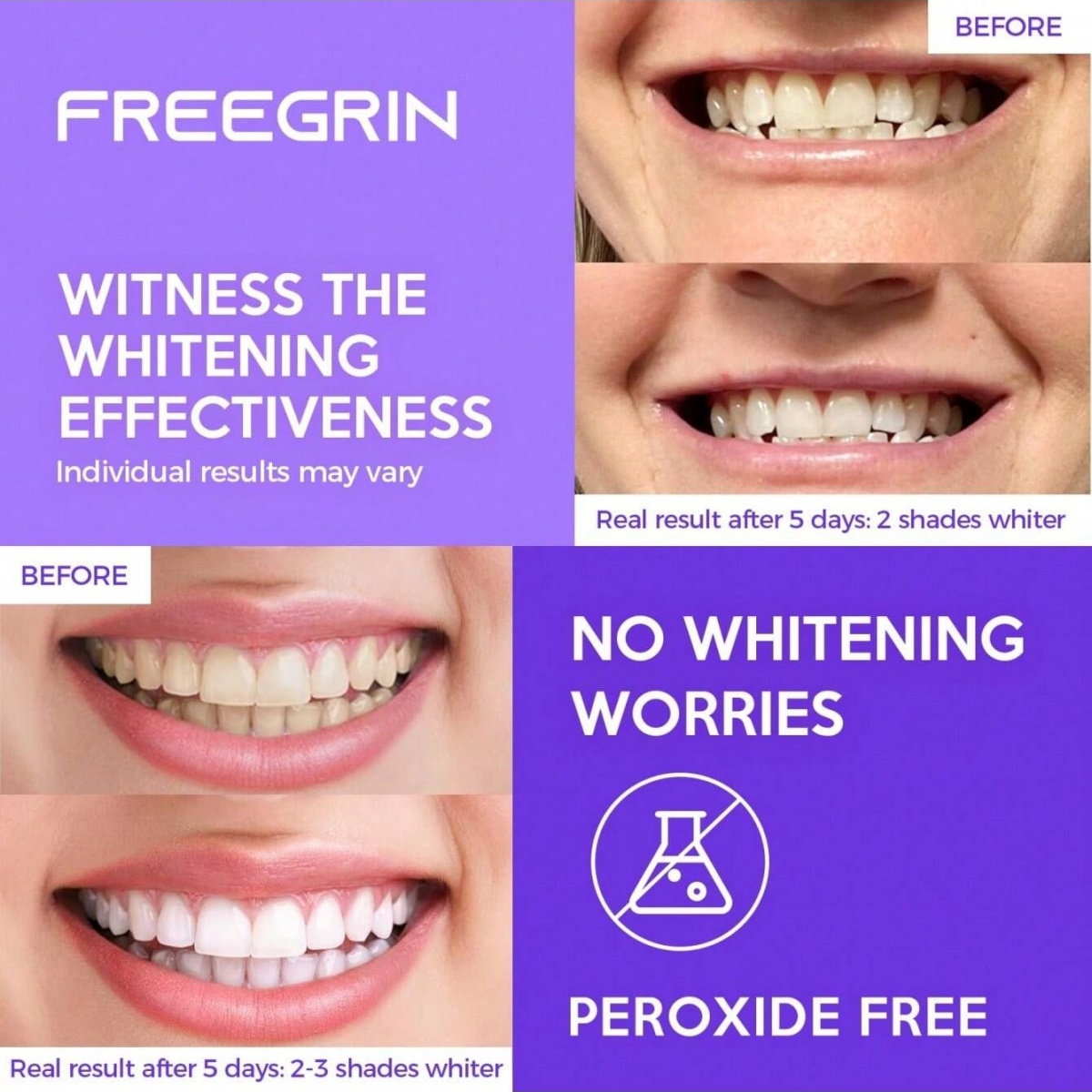 Deluxe Whitening Teeth Sticker - đánh giá và giá Teeth Whitening Hydrogen Peroxide