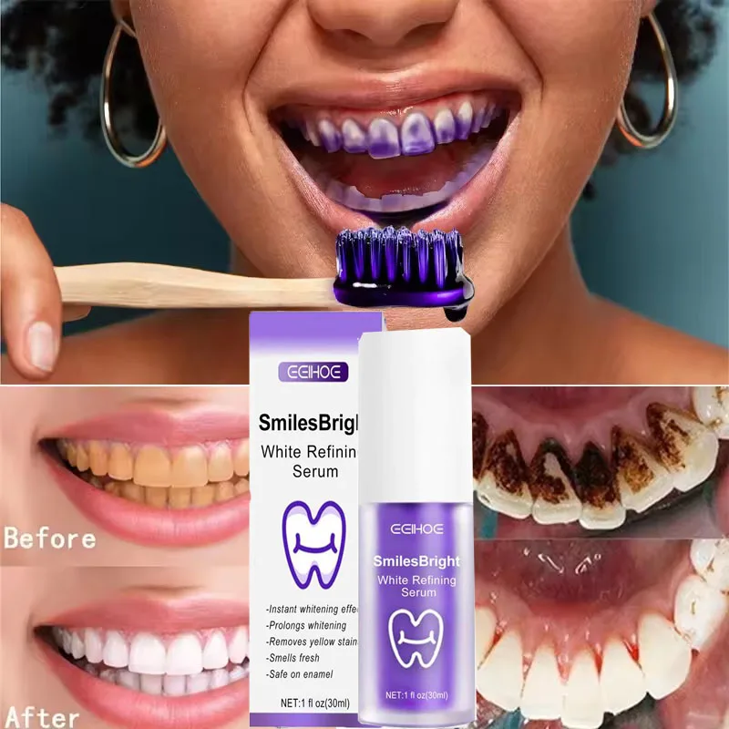 Whitening Toothpaste Teeth Cle - đánh giá và giá Teeth Whitening In Korea