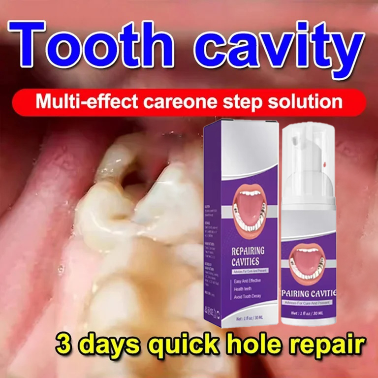 Teeth Cleaning Toothpaste Remo - đánh giá và giá Teeth Whitening Toothpaste