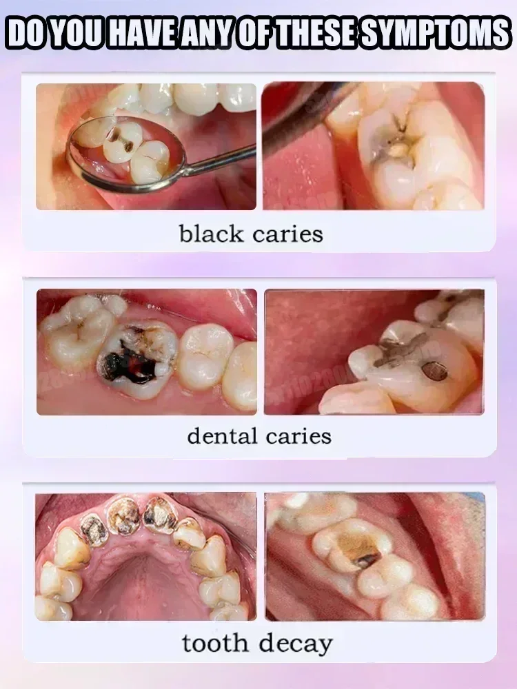 Teeth Cleaning Toothpaste Remo - đánh giá và giá Teeth Whitening Toothpaste
